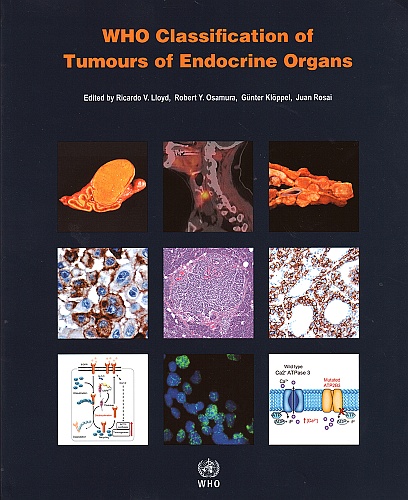 WHO Classification of Tumours of Endocrine Organs, Fourth Edition