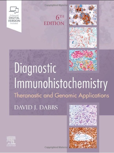 Diagnostic Immunohistochemistry: Theranostic and Genomic Applications, Expert Consult [Sixth Edition]
