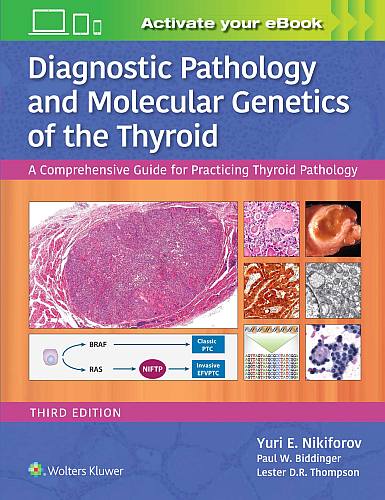 Diagnostic Pathology and Molecular Genetics of the Thyroid (3rd Edition)