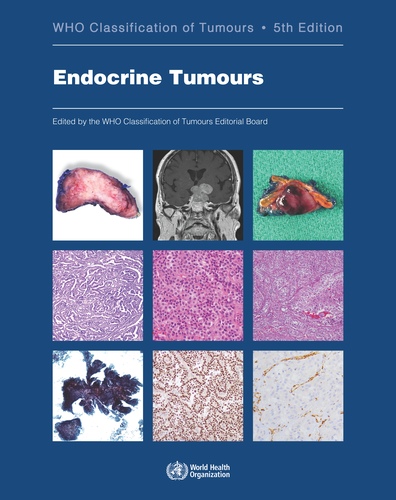World Health Organization Classification of Tumours -- Pathology & Genetics: Tumours of Endocrine Organs, 5th Edition