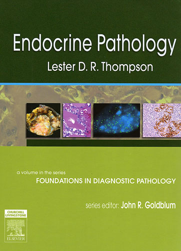 Endocrine Pathology:  A Volume in Foundations in  Diagnostic Pathology Series