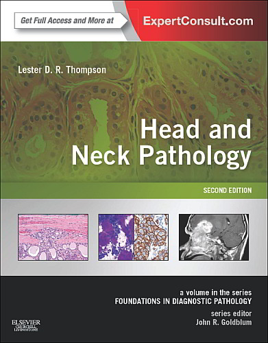 Head and Neck Pathology: A Volume in Foundations in Diagnostic Pathology Series 2nd Edition
