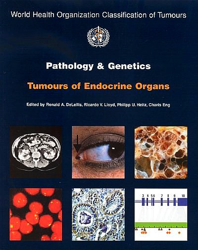 World Health Organization Classification of Tumours -- Pathology & Genetics: Tumours of Endocrine Organs, 3rd Edition