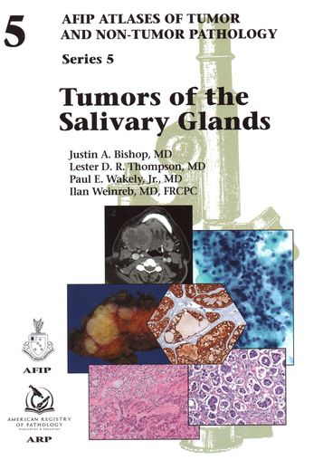 AFIP Atlas: Tumors of the Salivary Glands