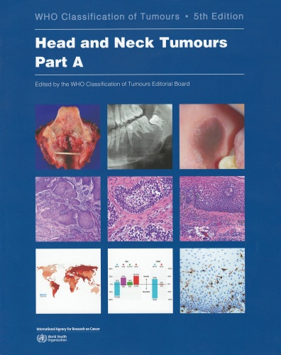 WHO Classification of Head and Neck Tumours, Part A. 5th edition