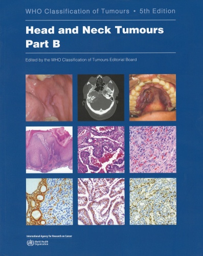 WHO Classification of Head and Neck Tumours, Part B. 5th edition